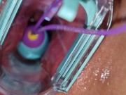 Preview 2 of vibrating egg in vagina opened by speculum causes intense orgasms
