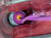 Preview 3 of vibrating egg in vagina opened by speculum causes intense orgasms