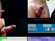 Preview 1 of E-Stim Session on 2B, from 3 angles
