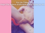 Preview 4 of COMPILATION: Anal, Fisting, Bladder Play & More!