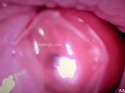 Preview 1 of Condom "Creampie" Camera in Vagina