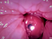 Preview 2 of Condom "Creampie" Camera in Vagina