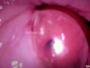 Preview 4 of Condom "Creampie" Camera in Vagina