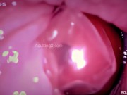 Preview 6 of Condom "Creampie" Camera in Vagina