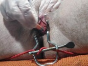 Preview 1 of Pens in Urethra + Lube Injection